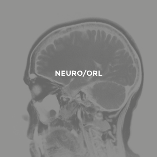 Neuro/orl